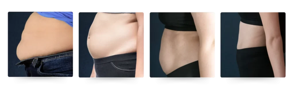 Perjalanan Metaponin Dalam Cara menurunkan Berat Badan